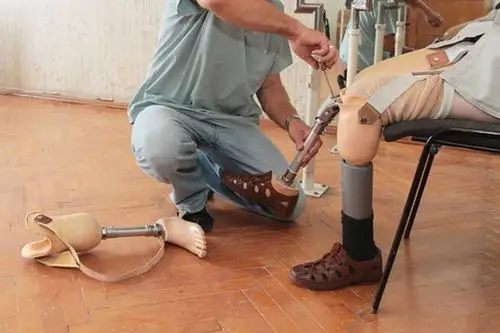 优邦假肢-下肢假肢膝关节主要组件及其选择