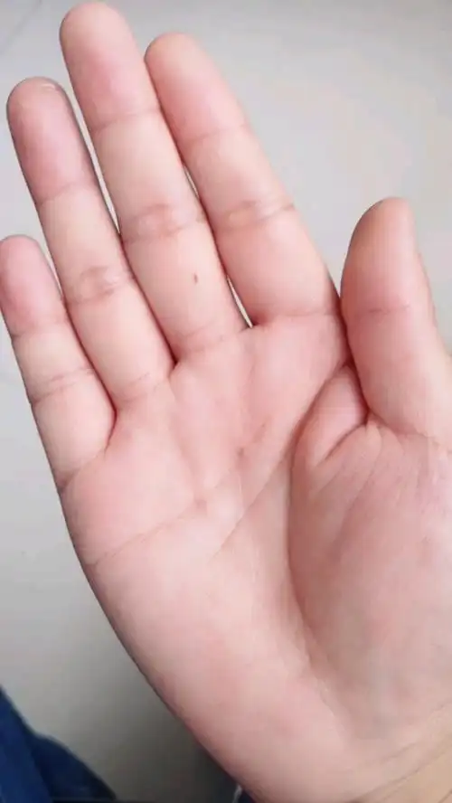 据说每个手心有痣的人,都是有故事的人!