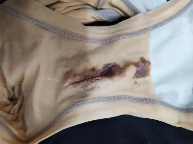 排卵期第四天,确拍出这样的颜色,怎么回事