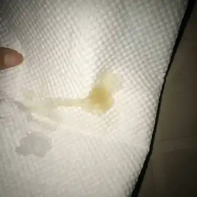 吃了乌鸡白凤丸炖猪腰第二天,排出来这些,检查卵泡15×19这不是排卵吧