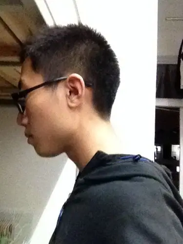 18岁脖子严重前倾怎么办?