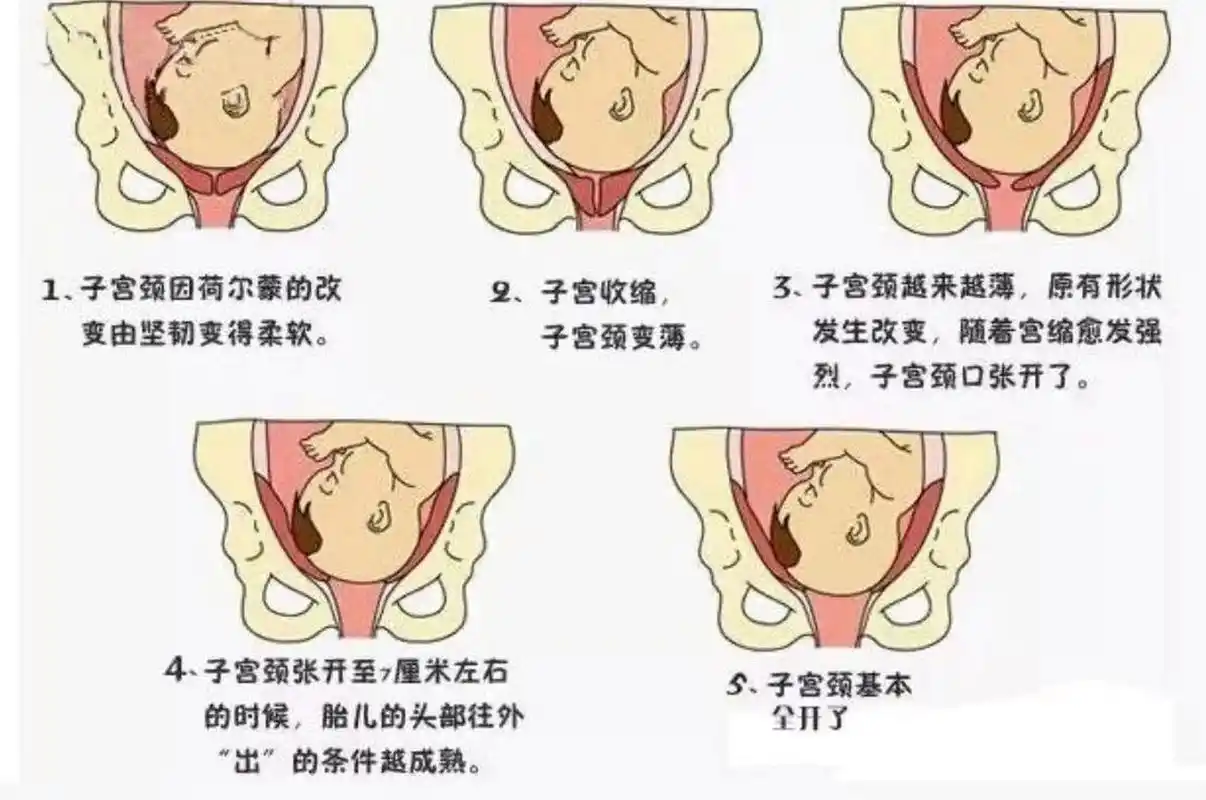 1,腹部形状发生变化 胎儿入盆后,所处的位置就相对靠下了,准妈妈的