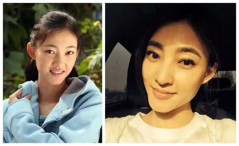 王丽坤一直被称为素颜美人,却没想到也有割双眼皮的时候,只能说双