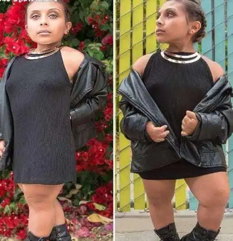 美国21岁侏儒女孩身高只有1米,同学叫她小矮人,如今成模特!