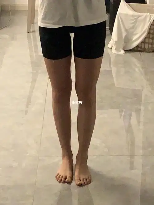 大腿内侧怎么破