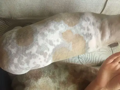 红黑的斑?我也不确定