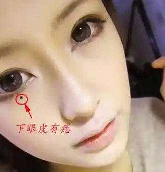 下眼皮有痣代表什么(下眼皮有痣好吗)