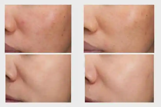 在高铁上发现了一个秘密|美白|色斑|面霜|抗老|胶原蛋白_网易订阅