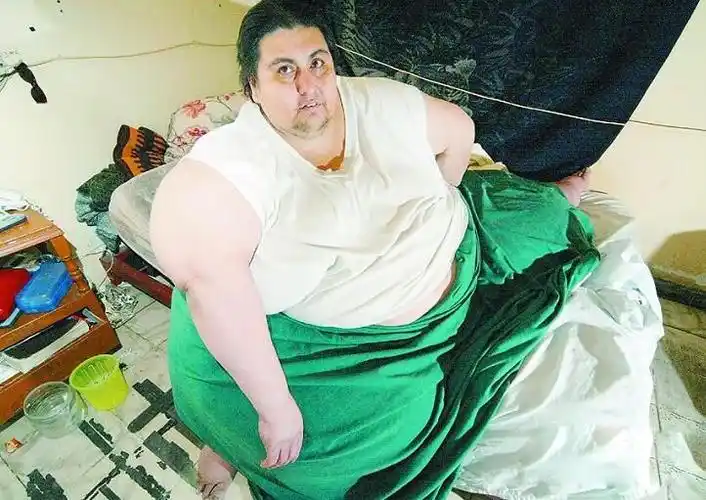 世界最胖男人,小时候体重达115公斤