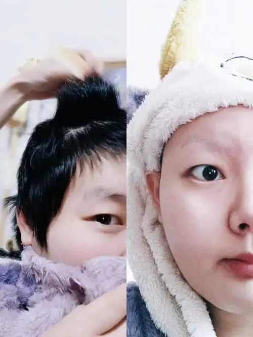 头发  #养头发  #剃眉毛  #眉毛全剃  #把眉毛剃了  #剃光眉毛头发