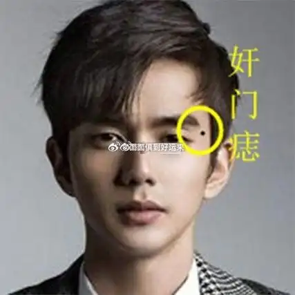 男人的克妻相,克妻痣,了解一下.