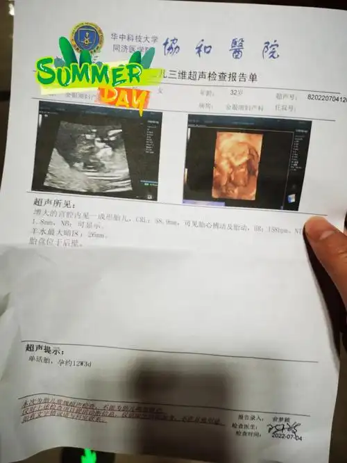 有会看nt的姐妹吗头胎好奇男宝宝女宝宝