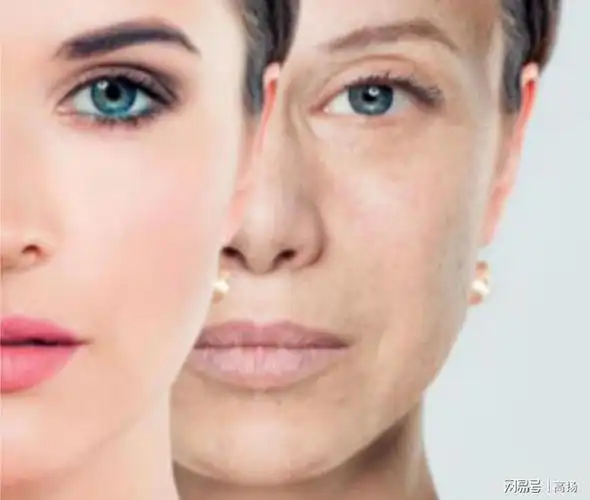 腹部拉皮手术前后照片拉皮一般大概多少钱看过不淡定了