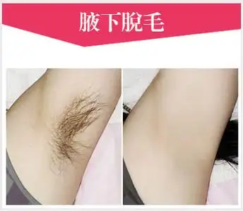 重庆潘多拉整形暑期特惠 冰点脱腋毛仅需88元-三元整形网
