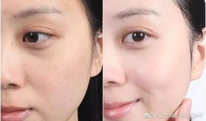 去暗黄前后对比