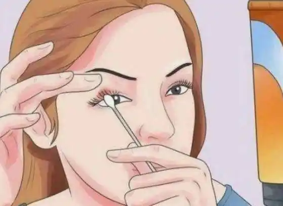 甚至有可能会带来眼部疾病,所以利用红霉素眼膏涂抹在眼上,会容易增加