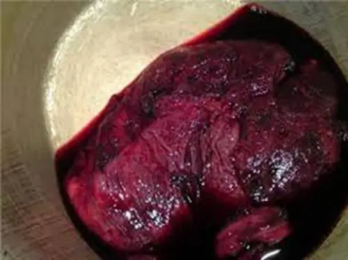 人胎盘详细的特征图片