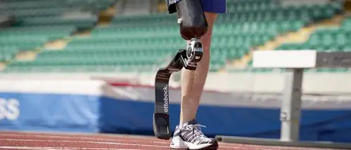 碳纤维增强复合材料储能假肢在竞技运动中的研究