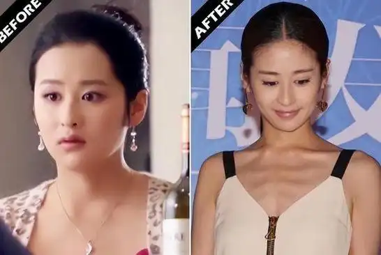 减肥过度的7位明星瘦了后简直惨不忍睹