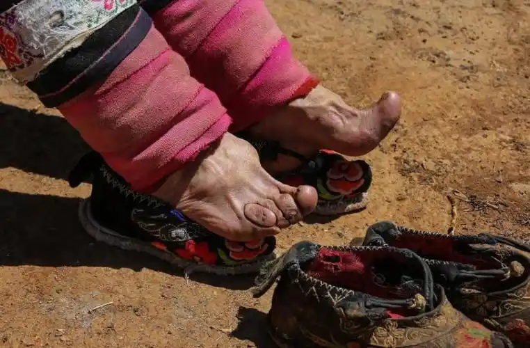 古代女人为什么裹小脚