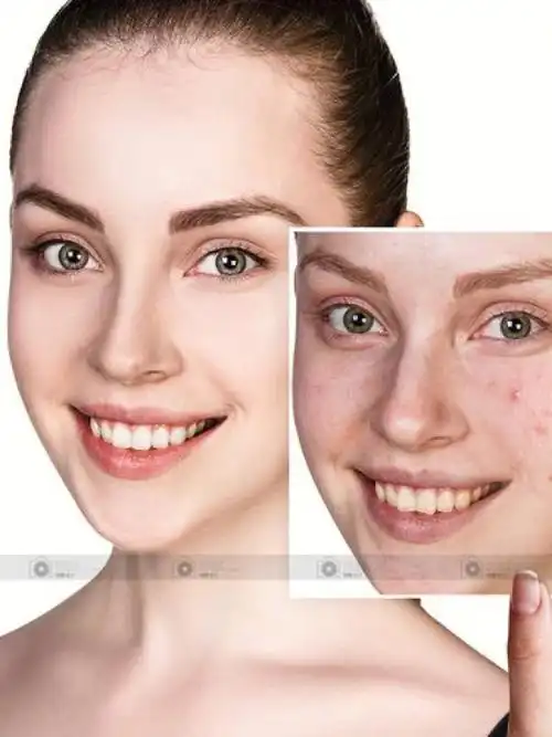 皮肤过了25岁开始衰老别怕控糖饮食能延缓