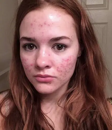 hma注导银膜明星都撑不过的熬夜脸你这边还好吗