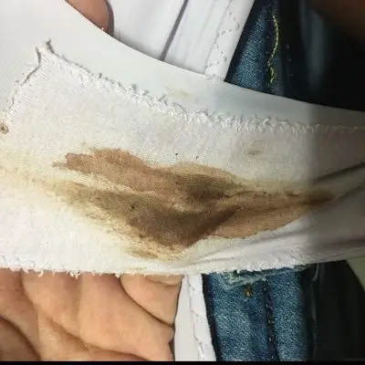 怎麼有血白带,持续一星期了,什麼情况,没有腥味.