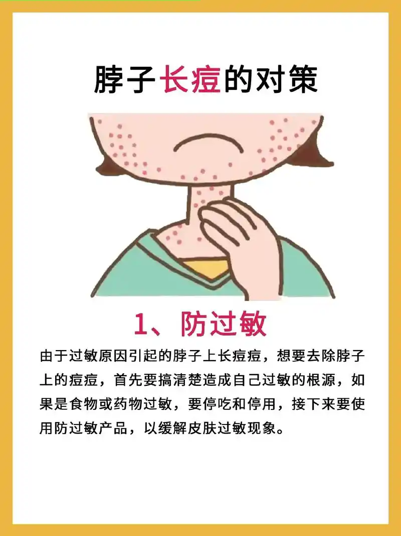 脖子长痘怎么办?可以看这几点! #知识分享 #祛痘 #痘痘  - 抖音