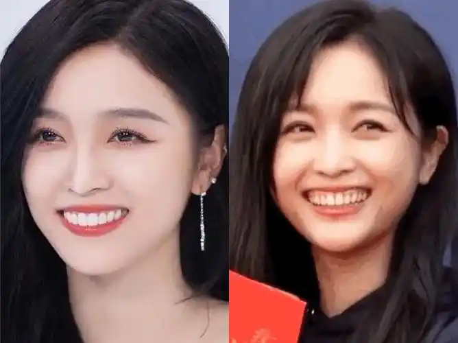 吴宣仪的牙变小了