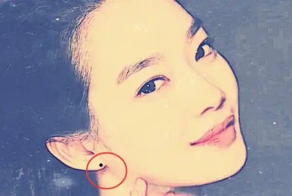 耳垂上长痣的人财运极佳为人忠厚健康长寿身体无虞