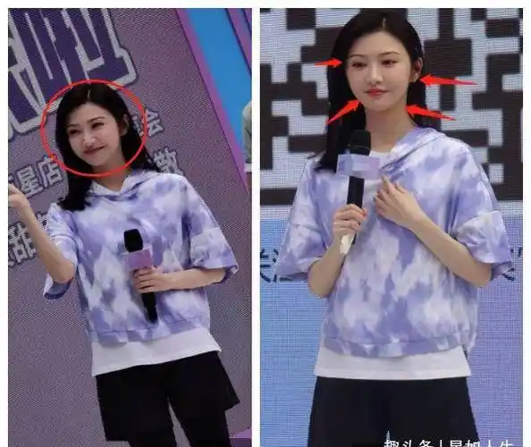 原创娱记曝景甜近照脸僵原因弄了微笑唇和鼻基底已离不开动脸