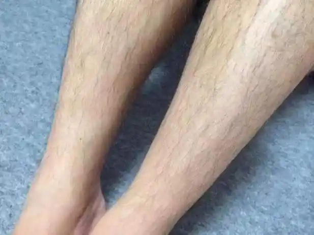 外网潮流:秀体毛?7岁就开始长毛的女生呼吁大家"拥抱毛毛"