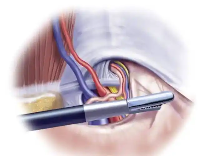 真实!男的睾丸穿刺的危害"注意事项"-第2张图片-云飞博客
