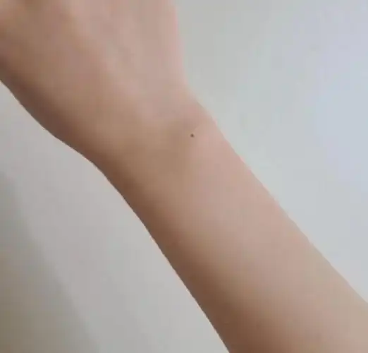 女人手腕上大部分都有一个黑点