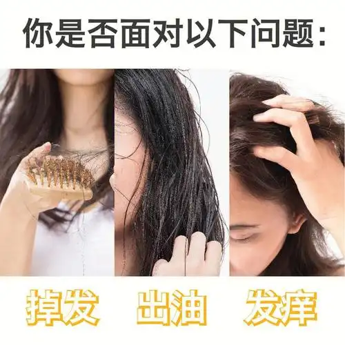 你到底要生发还是防脱63