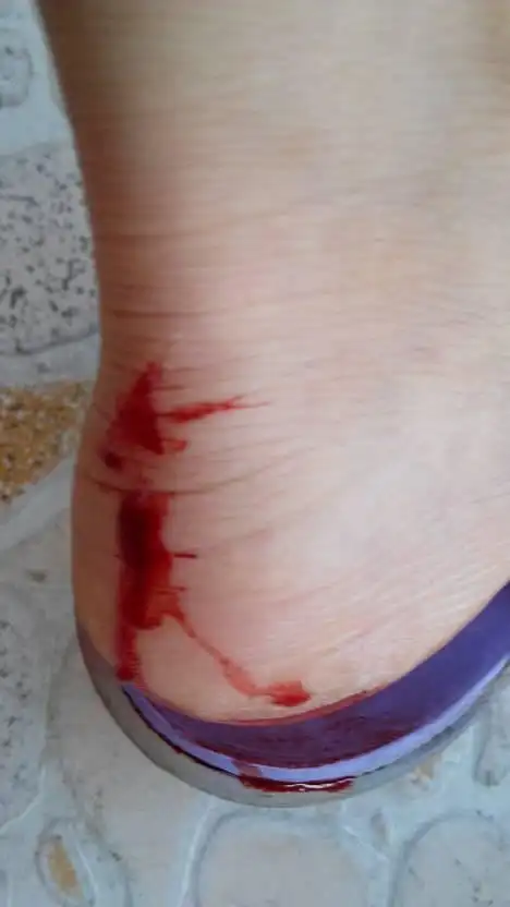 无缘无故流血了,我是不是很倒霉