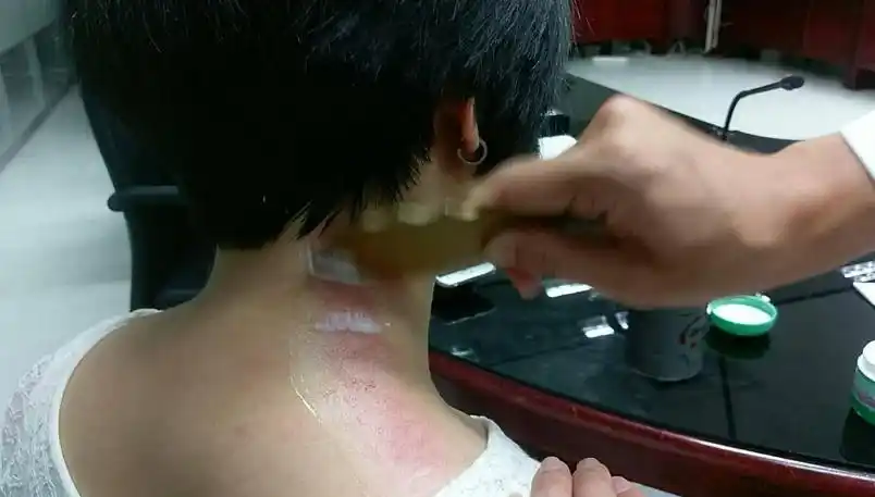 两个治疗满头白发的奇穴附方法