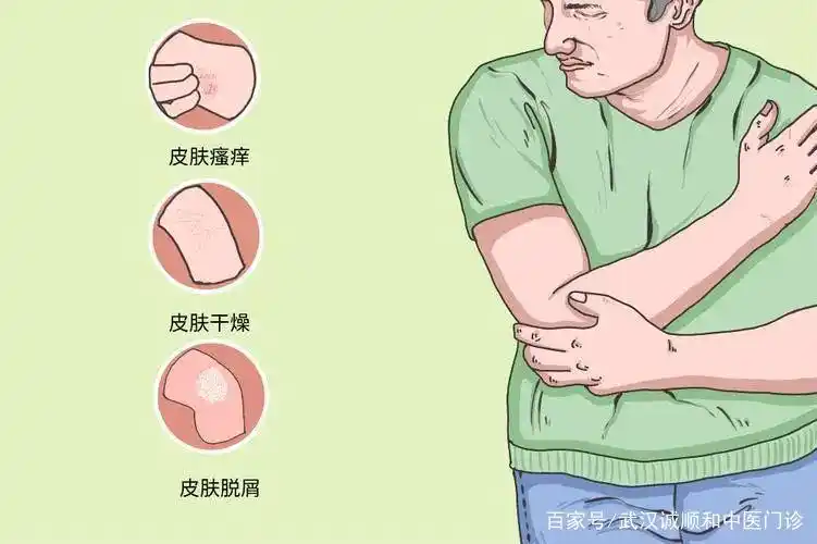 老年人皮肤干燥痒吃抗过敏药行吗