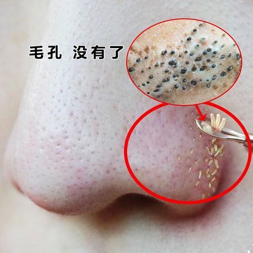 南京同仁堂水杨酸去黑头修复毛孔收缩毛孔精华液粗大细致水男女士 一