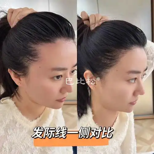 集美们发际线高怎么办02