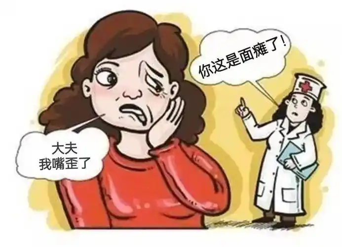 面瘫,又称"歪嘴巴""吊线风",西医又称面神经炎,面神经麻痹,是临床常见