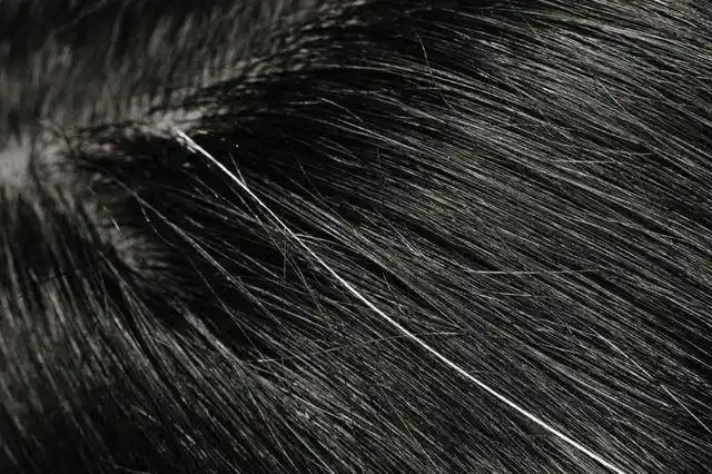 为什么白头发越长越多不要以为是自己老了