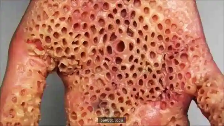 就会觉得感到恐惧,恶心,头晕,头皮发麻,起鸡皮疙瘩,轻重