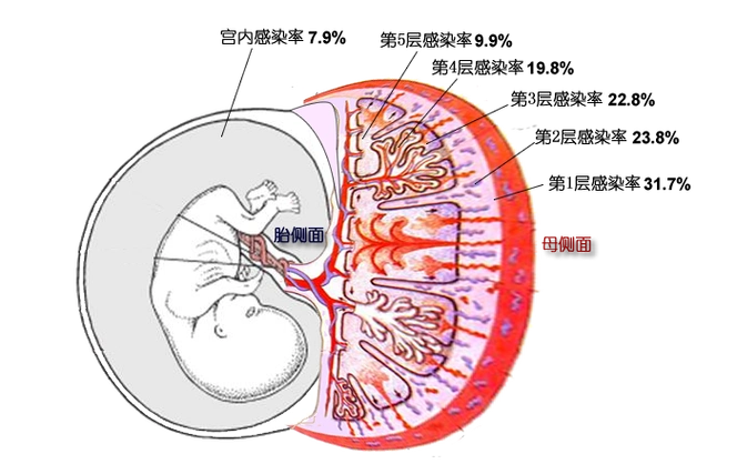 胎儿及胎盘各层的乙肝病毒感染率医生们发现,胎盘最靠近胎儿的第5层