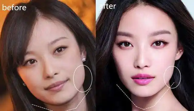 周笔畅整容成功,坦诚自曝:本来按照杨幂整,整完看着像杨紫