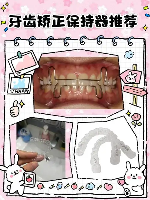牙齿矫正保持器推荐