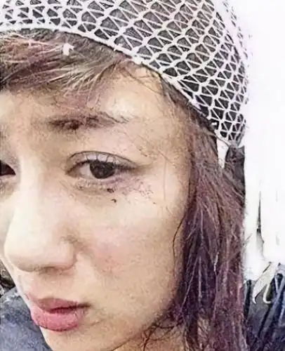 那只狗将李依晓脸啃得血肉模糊,在场所有的人都被吓得不轻,后来,还是