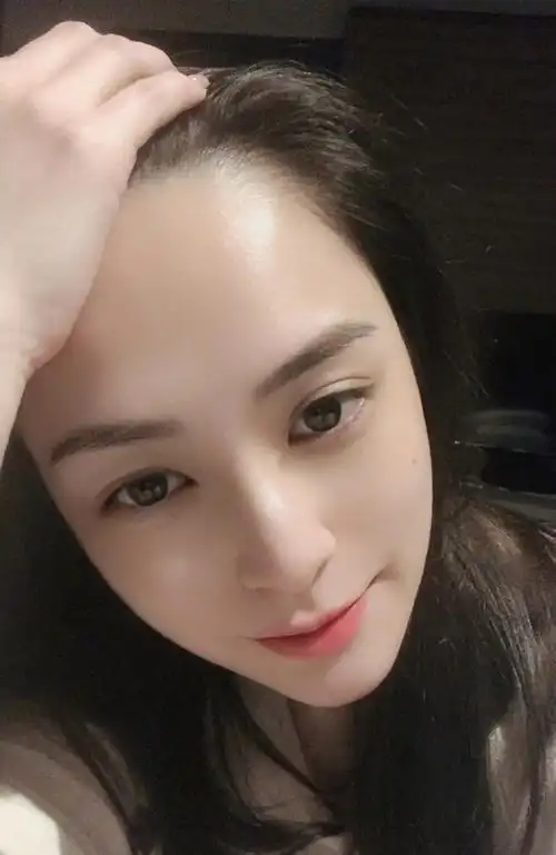 阿娇受伤过程曝光,伤口长达6cm,经纪人公开伤照发文报平安