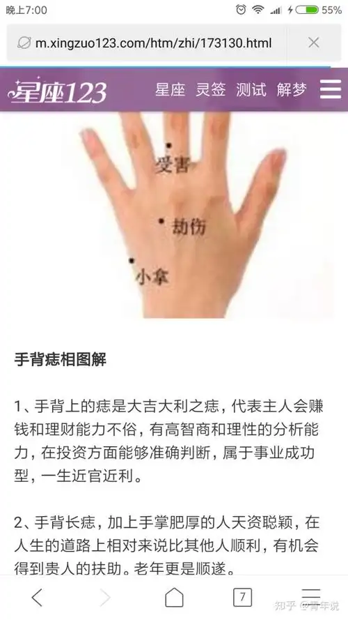 左手背上的痣 - 知乎