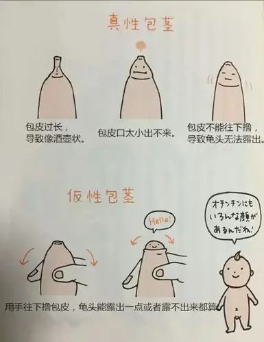 小儿包皮过长包茎怎么办 - 好大夫在线